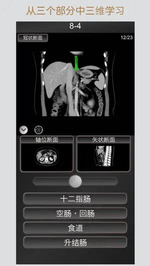 CT 护照测验 腹部 / 剖面解剖/ MRI截图2
