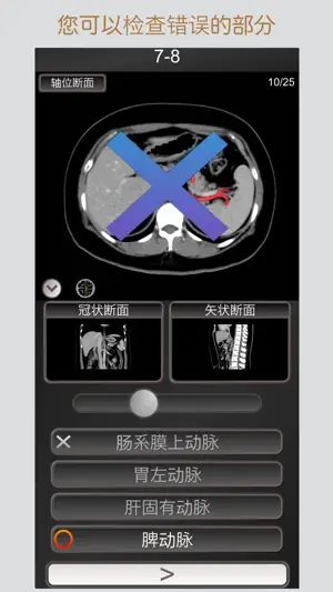 CT 护照测验 腹部 / 剖面解剖/ MRI截图1